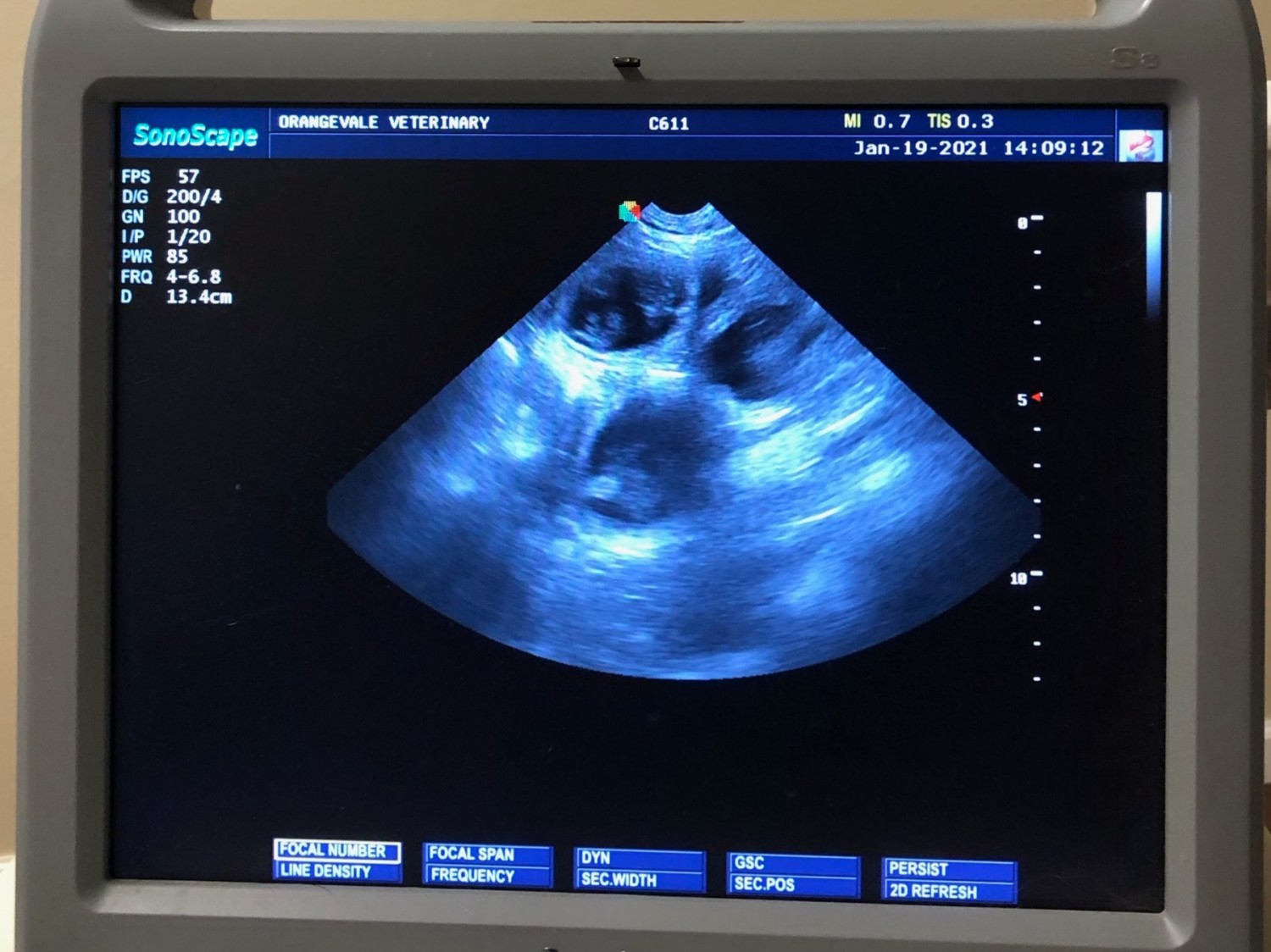 Ultrasound monitor